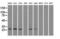 Hydroxysteroid 17-Beta Dehydrogenase 10 antibody, GTX84344, GeneTex, Western Blot image 