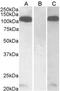 Furin, Paired Basic Amino Acid Cleaving Enzyme antibody, AHP2262, Bio-Rad (formerly AbD Serotec) , Western Blot image 