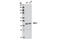 Damage Specific DNA Binding Protein 2 antibody, 5416T, Cell Signaling Technology, Western Blot image 
