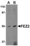 Fasciculation And Elongation Protein Zeta 2 antibody, MBS150398, MyBioSource, Western Blot image 