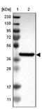 Monoacylglycerol O-Acyltransferase 3 antibody, NBP1-84299, Novus Biologicals, Western Blot image 