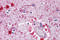 Piwi Like RNA-Mediated Gene Silencing 2 antibody, 6031, ProSci, Immunohistochemistry paraffin image 