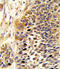 Protein Wnt-4 antibody, LS-C160633, Lifespan Biosciences, Immunohistochemistry paraffin image 