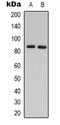 G Protein-Coupled Receptor Kinase 3 antibody, LS-C413232, Lifespan Biosciences, Western Blot image 