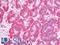 Lysyl Oxidase antibody, LS-C319075, Lifespan Biosciences, Immunohistochemistry frozen image 