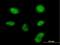 Zinc Finger CCHC-Type Containing 13 antibody, H00389874-B01P, Novus Biologicals, Immunocytochemistry image 