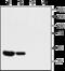 Potassium Voltage-Gated Channel Subfamily A Member 10 antibody, GTX16755, GeneTex, Western Blot image 