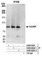 Holliday junction recognition protein antibody, A302-822A, Bethyl Labs, Immunoprecipitation image 