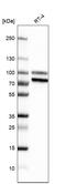 Tumor Protein P63 antibody, AMAb91224, Atlas Antibodies, Western Blot image 