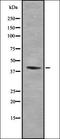 Ribosomal Modification Protein RimK Like Family Member B antibody, orb378281, Biorbyt, Western Blot image 