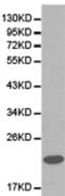 FXN antibody, TA321071, Origene, Western Blot image 
