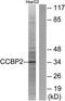 C-C Motif Chemokine Receptor 9 antibody, TA313638, Origene, Western Blot image 