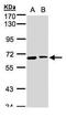 Sentrin-specific protease 2 antibody, TA308765, Origene, Western Blot image 