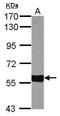 Sterol 26-hydroxylase, mitochondrial antibody, GTX103718, GeneTex, Western Blot image 