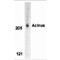 Apoptotic Chromatin Condensation Inducer 1 antibody, TA306018, Origene, Western Blot image 