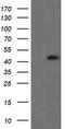 ALX Homeobox 4 antibody, TA505240AM, Origene, Western Blot image 