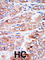 Nucleoside diphosphate kinase, mitochondrial antibody, abx033914, Abbexa, Western Blot image 