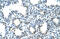 Semenogelin 1 antibody, ARP42088_T100, Aviva Systems Biology, Immunohistochemistry paraffin image 
