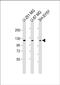 SH3 And PX Domains 2B antibody, PA5-72309, Invitrogen Antibodies, Western Blot image 