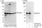 Proteasome 26S Subunit, ATPase 6 antibody, A303-825A, Bethyl Labs, Immunoprecipitation image 