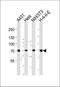 Cytochrome P450 Family 2 Subfamily C Member 19 antibody, orb304733, Biorbyt, Western Blot image 