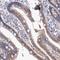 Synapse Associated Protein 1 antibody, HPA000175, Atlas Antibodies, Immunohistochemistry paraffin image 