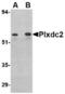 Plexin domain-containing protein 2 antibody, TA306510, Origene, Western Blot image 