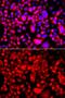 FAS antibody, GTX32598, GeneTex, Immunofluorescence image 