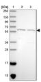 RBM35B antibody, PA5-61779, Invitrogen Antibodies, Western Blot image 