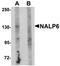 NLR Family Pyrin Domain Containing 6 antibody, orb75487, Biorbyt, Western Blot image 