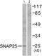 Synaptosome Associated Protein 25 antibody, TA326256, Origene, Western Blot image 