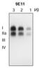 Solute Carrier Family 18 Member A2 antibody, MA5-24939, Invitrogen Antibodies, Western Blot image 