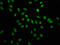 Heterogeneous Nuclear Ribonucleoprotein A1 antibody, LS-C285531, Lifespan Biosciences, Immunofluorescence image 