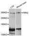 FBN2 antibody, LS-B15567, Lifespan Biosciences, Western Blot image 