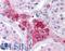 SCP1 antibody, LS-C142080, Lifespan Biosciences, Immunohistochemistry paraffin image 