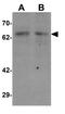 Dual specificity tyrosine-phosphorylation-regulated kinase 2 antibody, GTX31833, GeneTex, Western Blot image 
