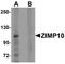 Zinc Finger MIZ-Type Containing 1 antibody, orb75588, Biorbyt, Western Blot image 