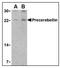 Cerebellin 1 Precursor antibody, AP07693PU-N, Origene, Western Blot image 
