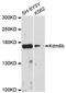 Lysine-specific demethylase 6B antibody, A12763, ABclonal Technology, Western Blot image 