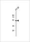 Hepatic triacylglycerol lipase antibody, GTX50912, GeneTex, Western Blot image 