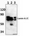 Lamin A/C antibody, A00438S17, Boster Biological Technology, Western Blot image 