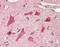 Early Endosome Antigen 1 antibody, LS-B14173, Lifespan Biosciences, Immunohistochemistry paraffin image 