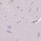 Chymotrypsin Like antibody, PA5-56958, Invitrogen Antibodies, Immunohistochemistry frozen image 
