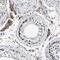 NK-tumor recognition protein antibody, HPA022120, Atlas Antibodies, Immunohistochemistry paraffin image 