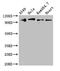 Toll Like Receptor 5 antibody, CSB-PA023604LA01HU, Cusabio, Western Blot image 