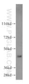 Small ArfGAP2 antibody, 16597-1-AP, Proteintech Group, Western Blot image 