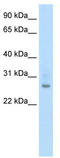 Cyclic AMP-dependent transcription factor ATF-1 antibody, TA343511, Origene, Western Blot image 