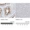 ADAM Metallopeptidase Domain 2 antibody, NBP1-85415, Novus Biologicals, Immunohistochemistry paraffin image 