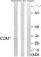 Catechol O-methyltransferase antibody, TA326243, Origene, Western Blot image 