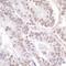 NCOA6 antibody, NB200-335, Novus Biologicals, Immunohistochemistry paraffin image 